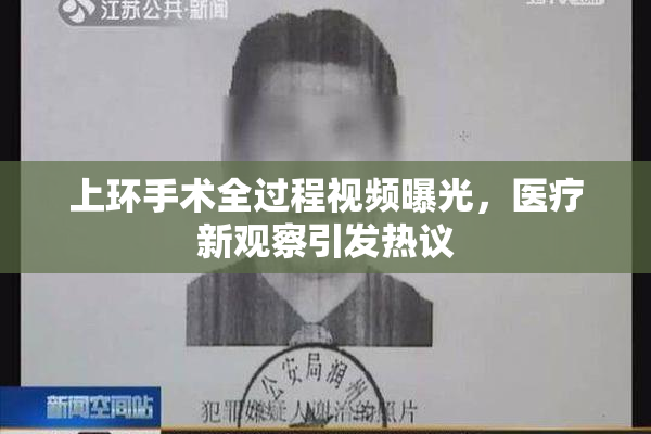 上环手术全过程视频曝光，医疗新观察引发热议