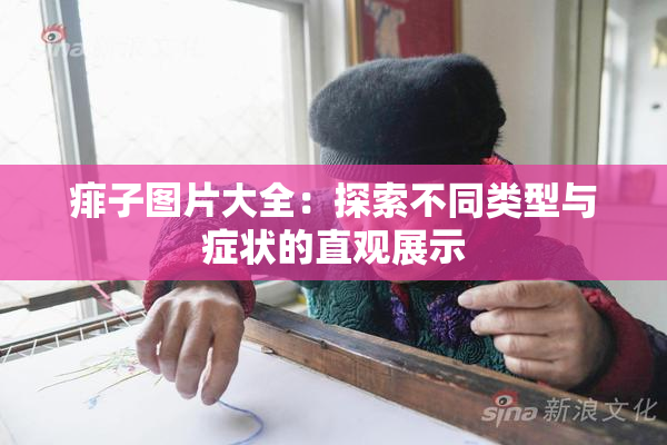 痱子图片大全：探索不同类型与症状的直观展示