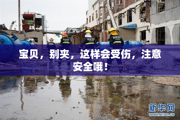 宝贝，别夹，这样会受伤，注意安全哦！