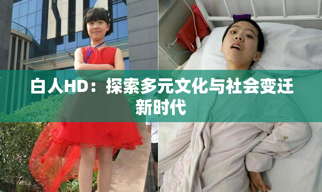 白人HD：探索多元文化与社会变迁新时代