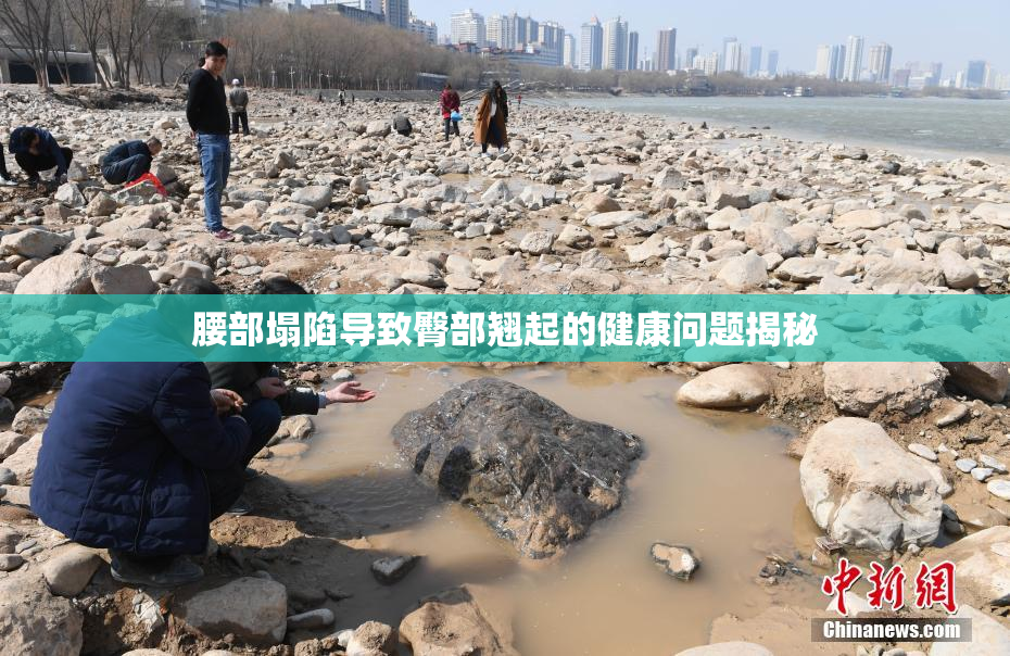 腰部塌陷导致臀部翘起的健康问题揭秘