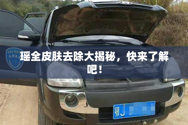 瑶全皮肤去除大揭秘，快来了解吧！
