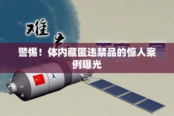 警惕！体内藏匿违禁品的惊人案例曝光