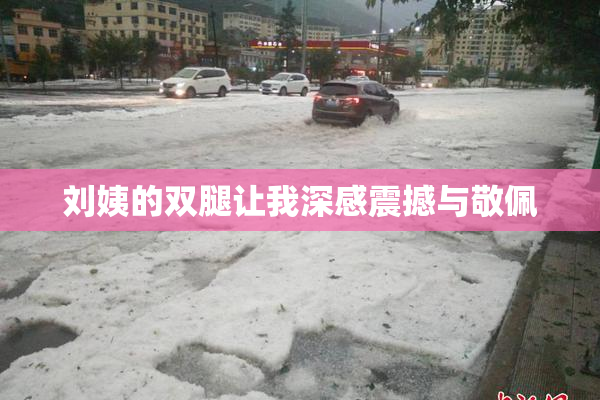 刘姨的双腿让我深感震撼与敬佩